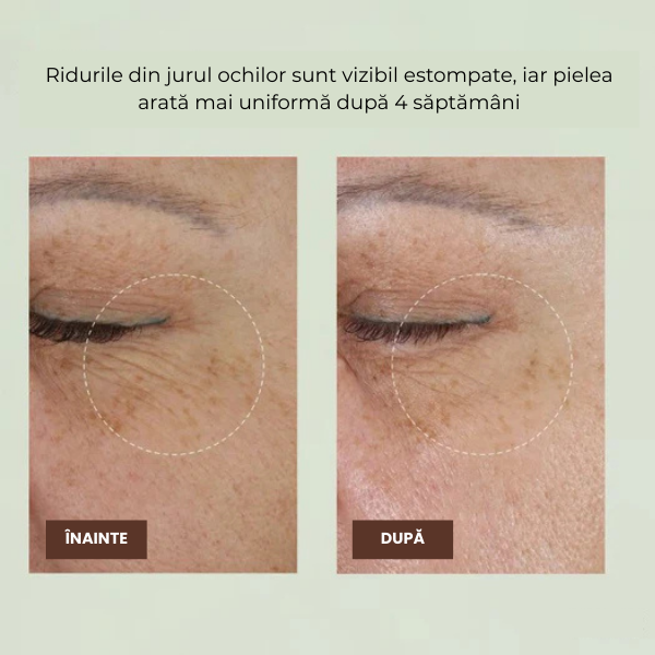 Ser fermitate cu retinal — riduri reduse, fermitate și strălucire vizibilă în doar 4 săptămâni