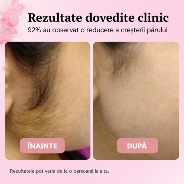 ⭐NetedPlus ⭐ - ulei esențial pentru încetinirea creșterii firelor de păr