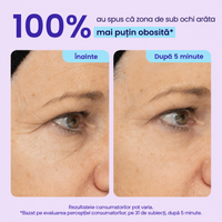 Gel cu Efect Instant de Lifting pentru Conturul Ochilor
