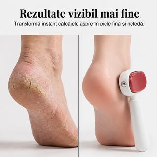 2 în 1 Pilă pentru îndepărtarea calusului din oțel inoxidabil