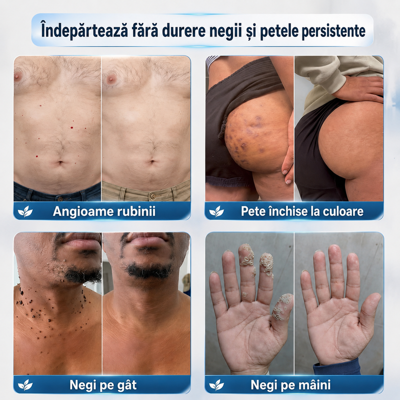 Stilou de îngrijire pentru imperfecțiuni