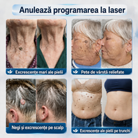 Stilou de îngrijire pentru imperfecțiuni