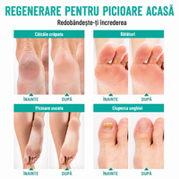 Mască Jeleu pentru picioare - SPA la tine acasă